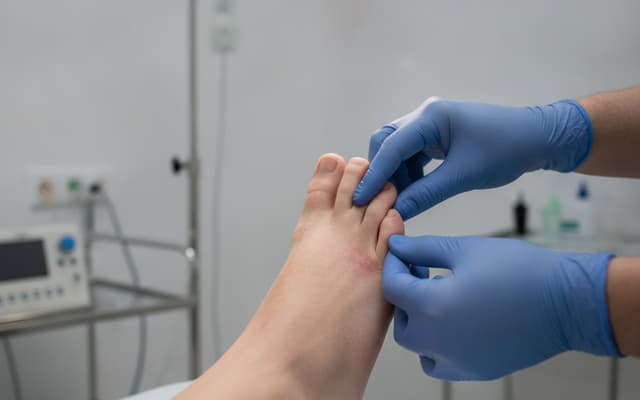 Amputacje stopy cukrzycowej da się ograniczyć. Lepsza organizacja leczenia